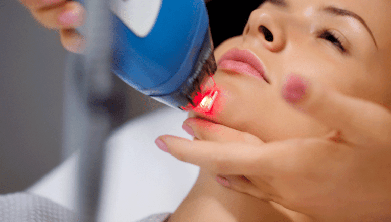 Rejuvenation of the field of the skin