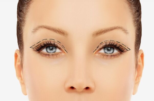 The outline of the eyelids